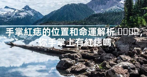 手掌紅痣的位置和命運解析，你手掌上有紅痣嗎